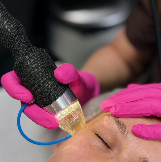 Radiofrekwencja mikroigłowa | RF Frakcyjny Lapio Professional® + GRATIS Szkolenie 